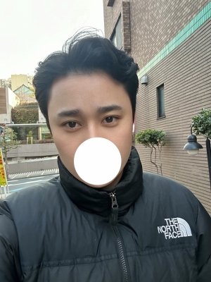 JERA(ｼﾞｪﾗ) 毛髪