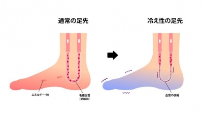 REO (ﾚｵ) 末端冷え性は治しましょう♪