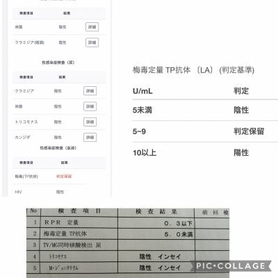 HANZO（ﾊﾝｿﾞｰ） 検査