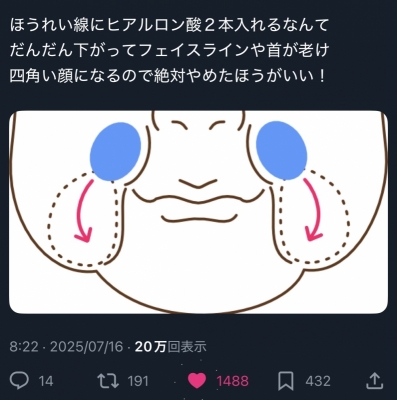 SHUSUKE(ｼｭｳｽｹ) 美容整形に精通してる方へ