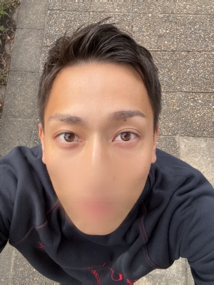 YOTSUBA(ﾖﾂﾊﾞ) ツイキャス✨