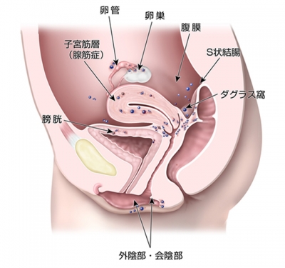 KANZAKI(ｶﾝｻﾞｷ) 施術方法⑥膣内触診２