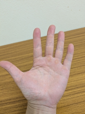 TERU(ﾃﾙ) 僕の手