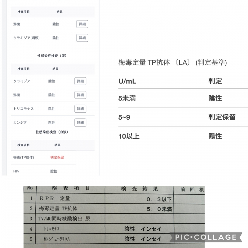 HANZO(ハンゾー) 検査