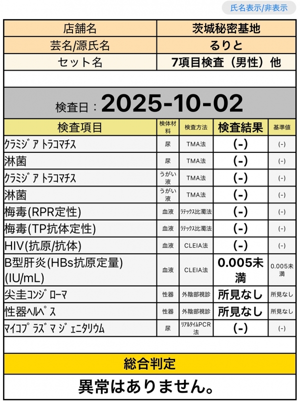 RURITO(ﾙﾘﾄ) 性病検査について