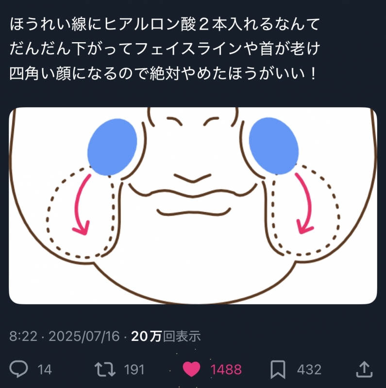 SHUSUKE(シュウスケ) 美容整形に精通してる方へ