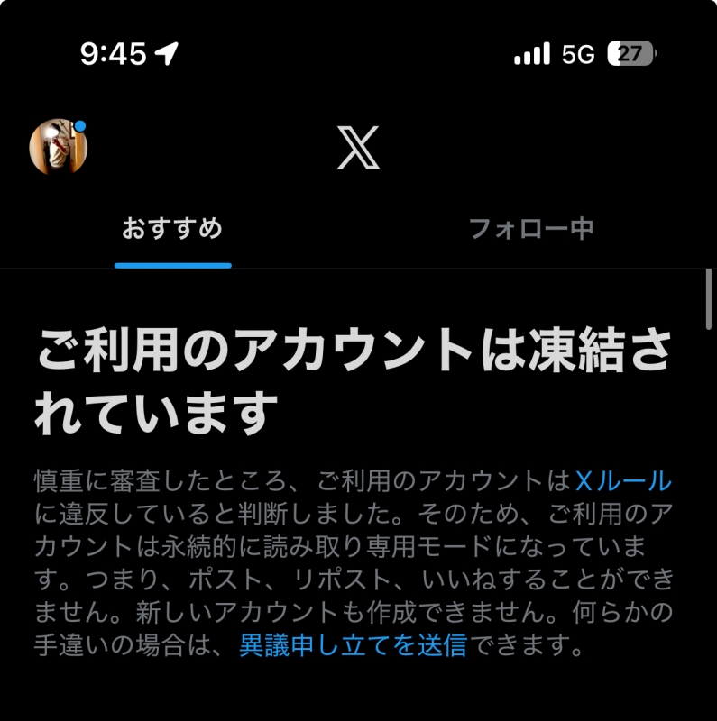 NOBU（ﾉﾌﾞ） 連日のX凍結