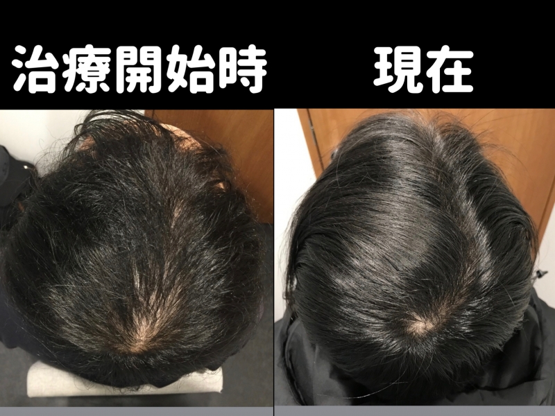 ATSUMU（ｱﾂﾑ） 大暴露