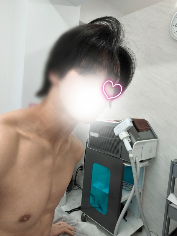 SOU(ｿｳ) 全身脱毛からの生還!!!!🔥