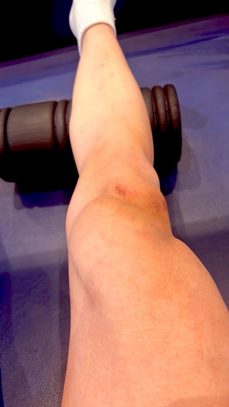 KOH(コウ) 人体の中で1番デカい筋肉