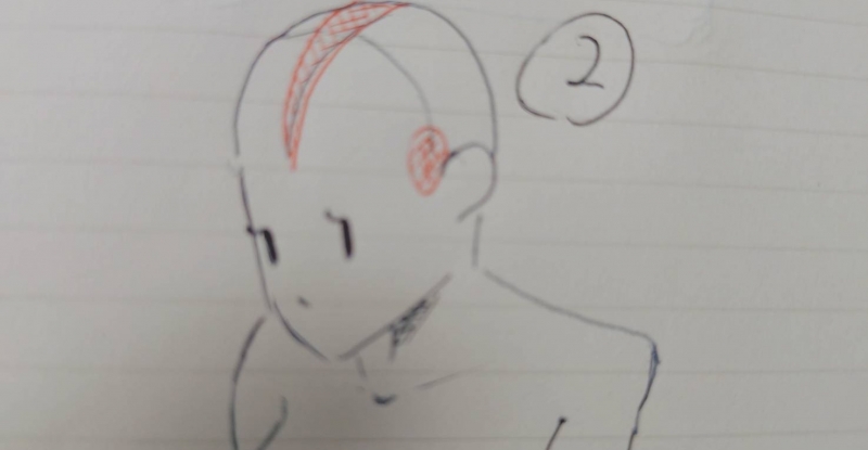 IGA（ｲｶﾞ） 感度を上げるためのほぐし